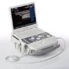ACUSON P300 Ultrasound System