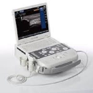 ACUSON P300 Ultrasound System
